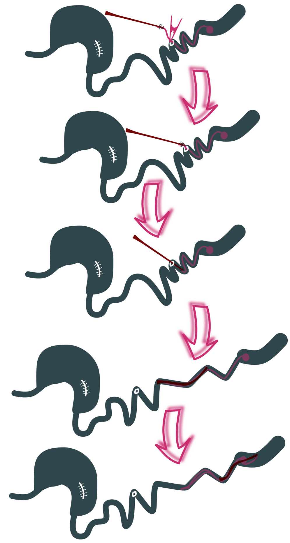 Pictograph of attaching red rubber feeding tube