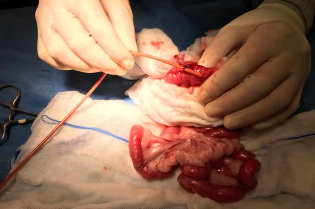 Picture of attaching red rubber feeding tube in surgery